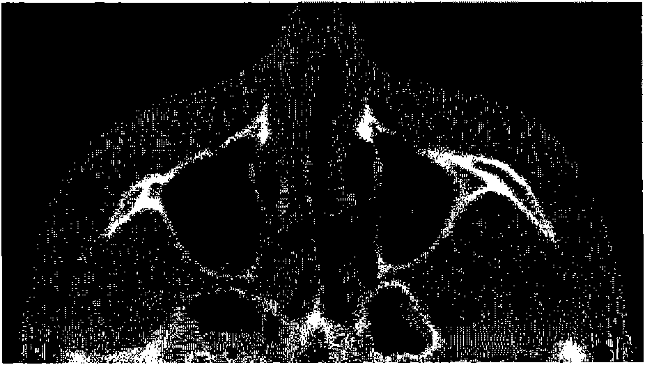 Bone model, bone filler and process for producing bone filler