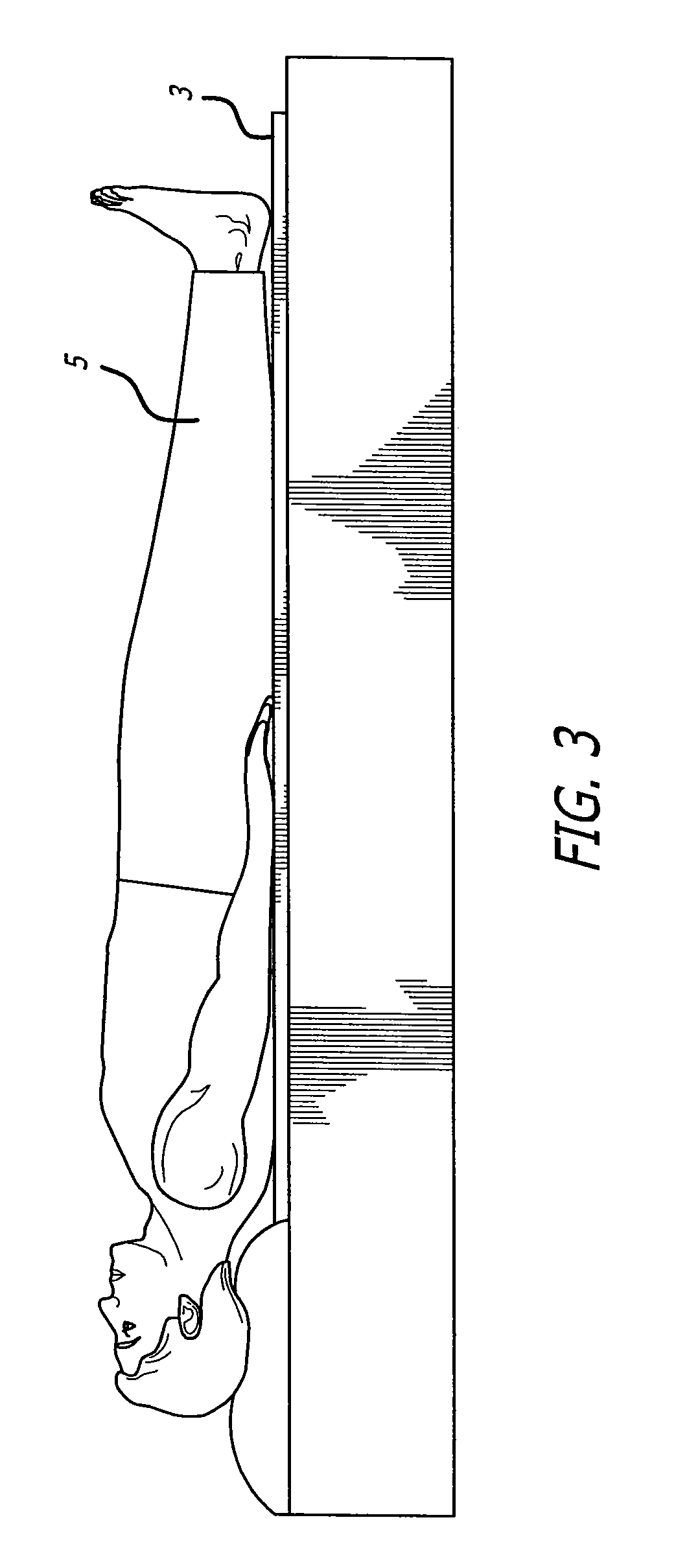 Radiation stress non-invasive blood pressure method