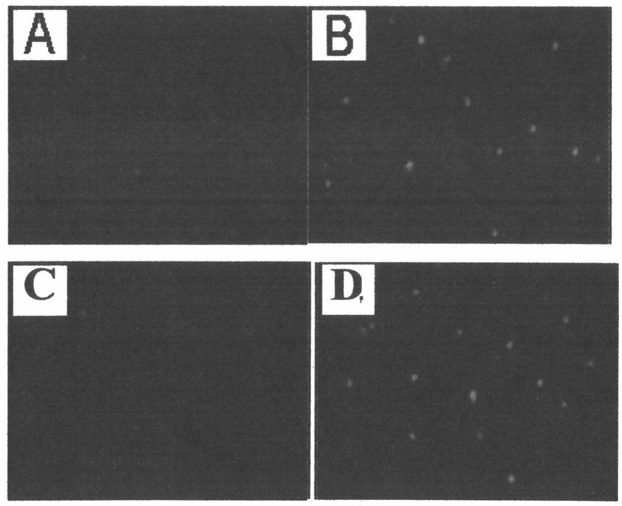 Tumor chemotherapeutic medicinal preparation and preparation method thereof