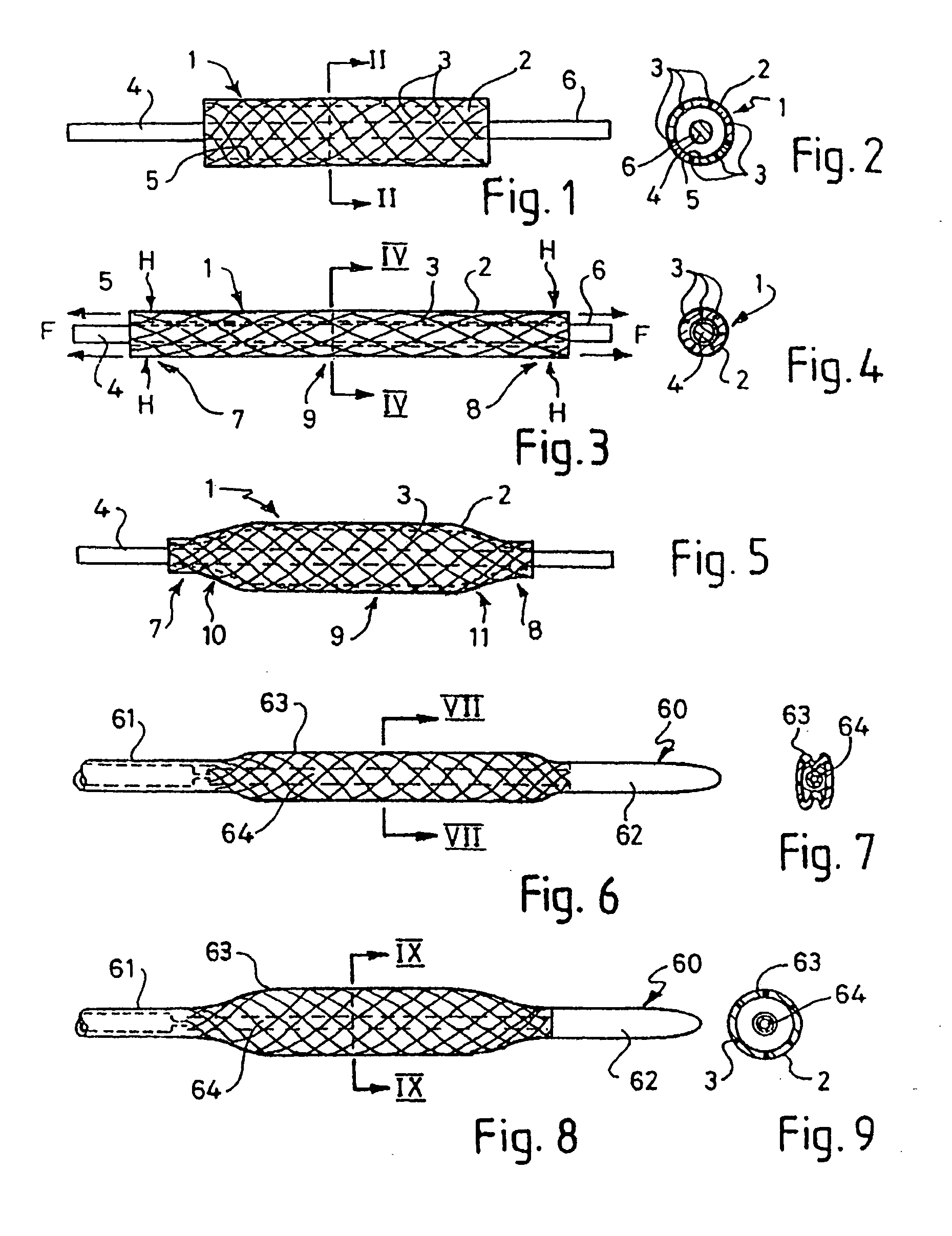 Balloon catheter