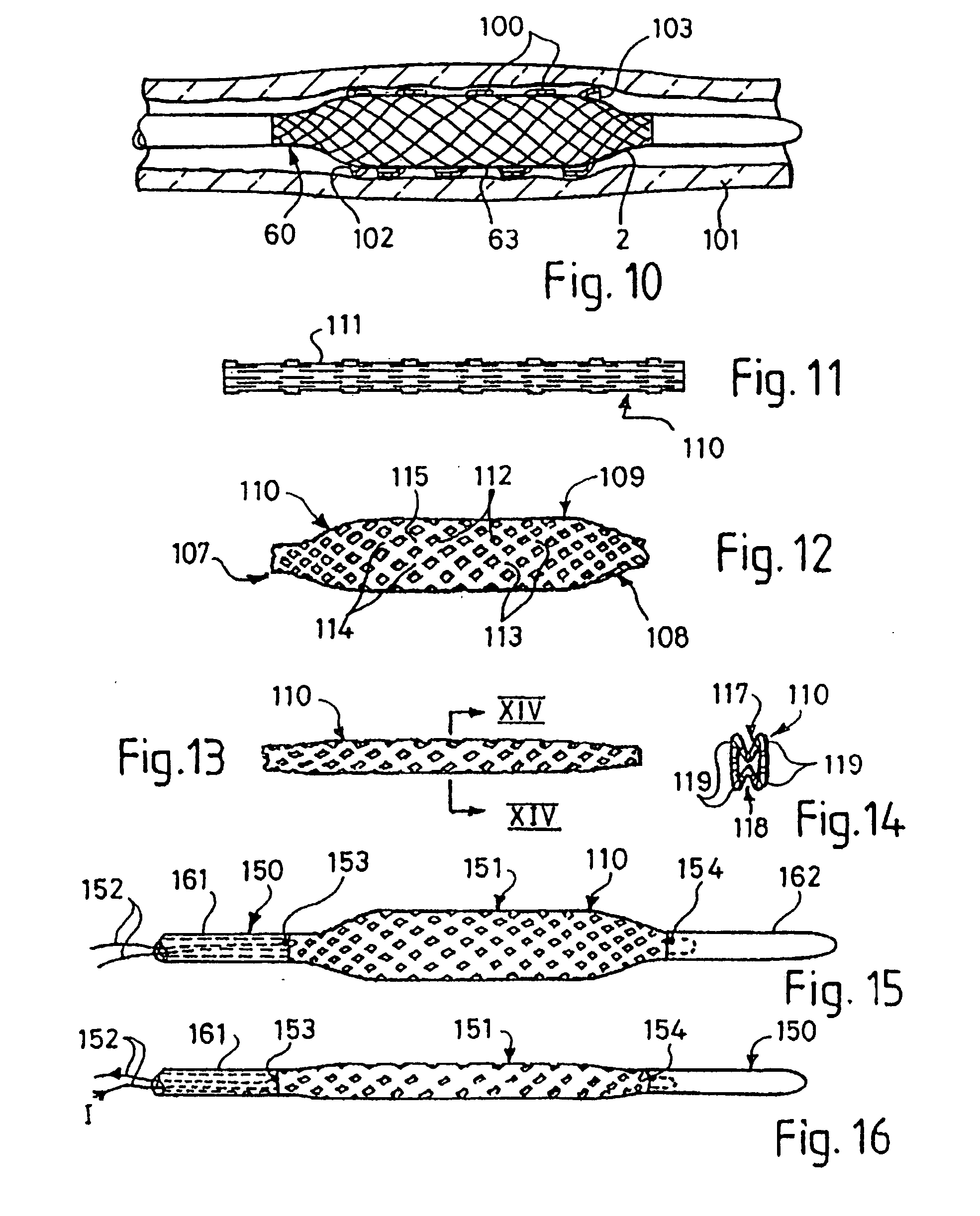 Balloon catheter