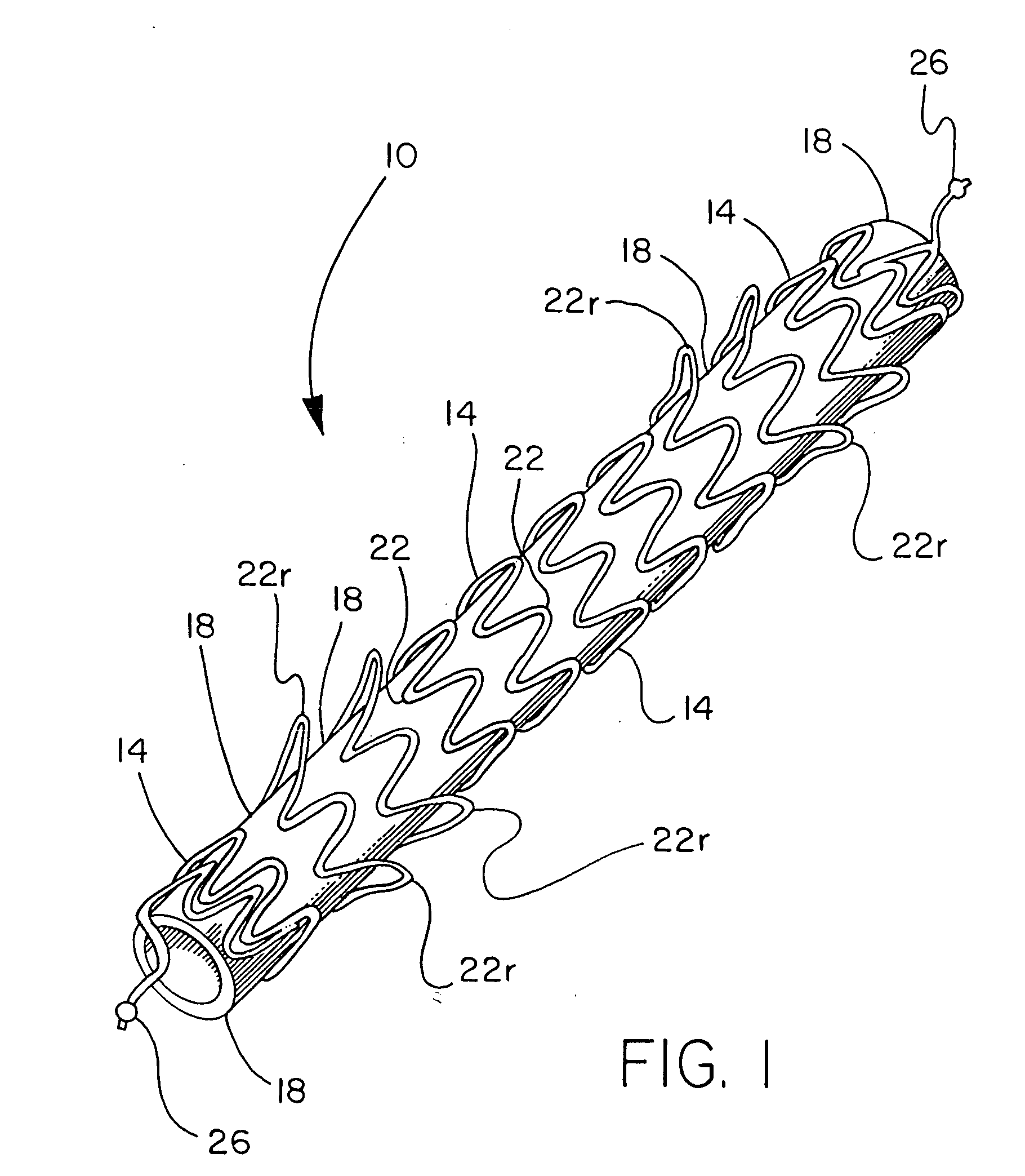 Removable stent-graft