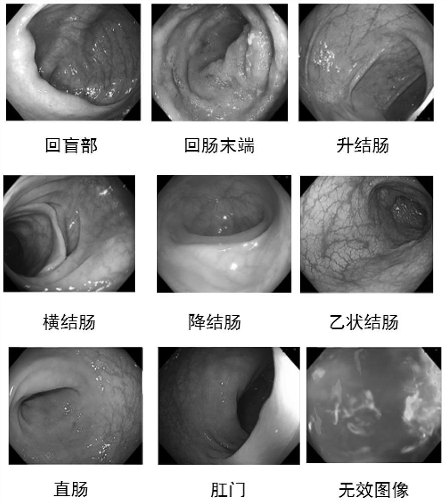 Method and device for monitoring intestinal endoscopy