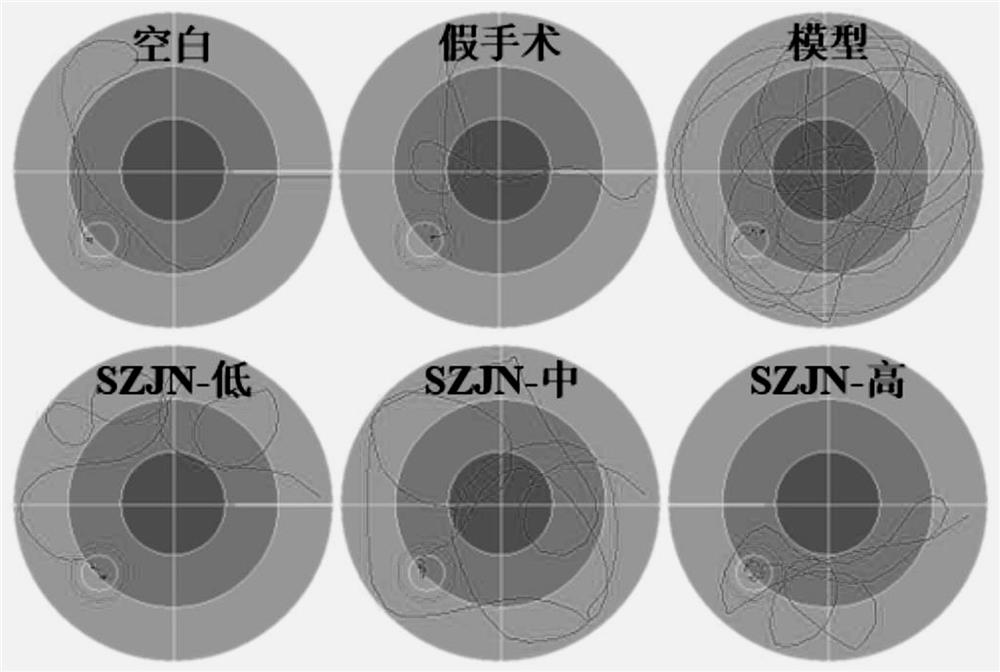 Use of Shenzao Jiannao Oral Liquid in the Preparation of Drugs for Preventing and/or Treating Alzheimer's Disease