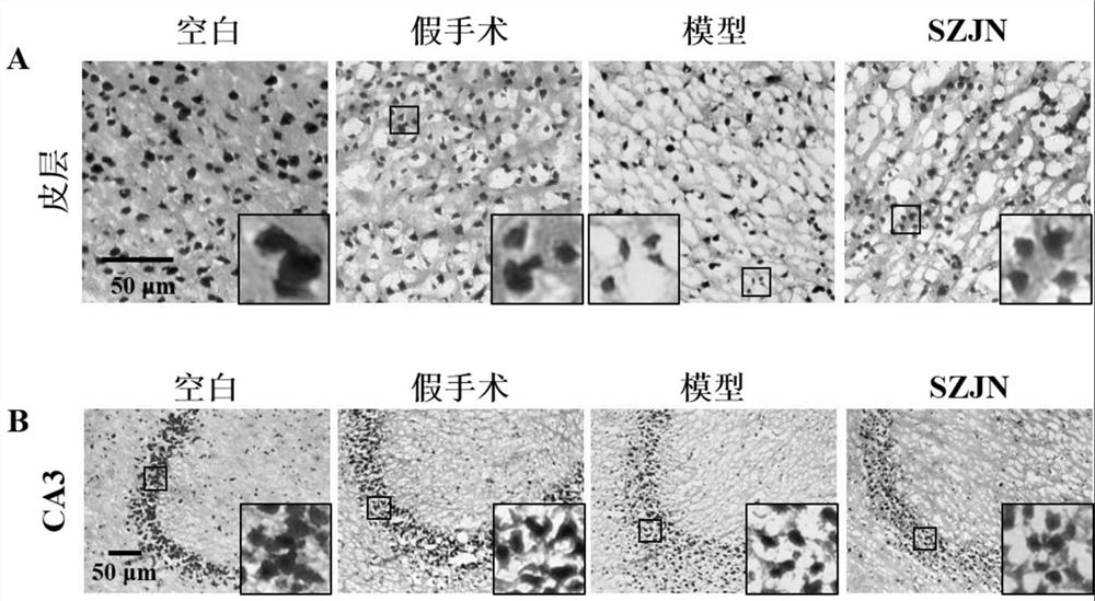 Use of Shenzao Jiannao Oral Liquid in the Preparation of Drugs for Preventing and/or Treating Alzheimer's Disease