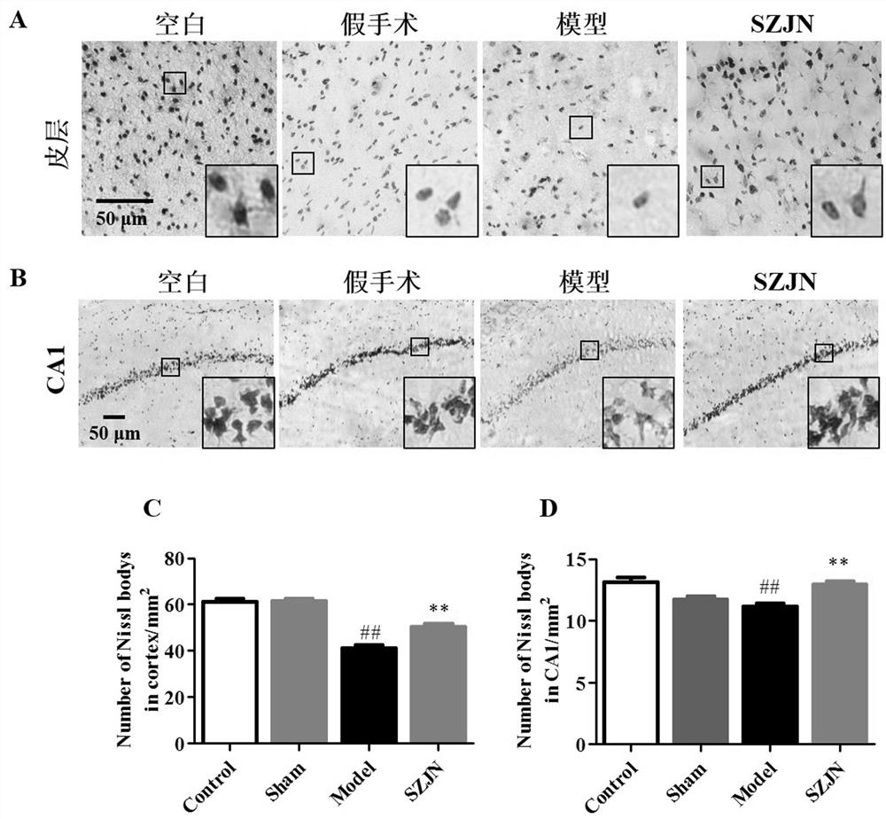 Use of Shenzao Jiannao Oral Liquid in the Preparation of Drugs for Preventing and/or Treating Alzheimer's Disease