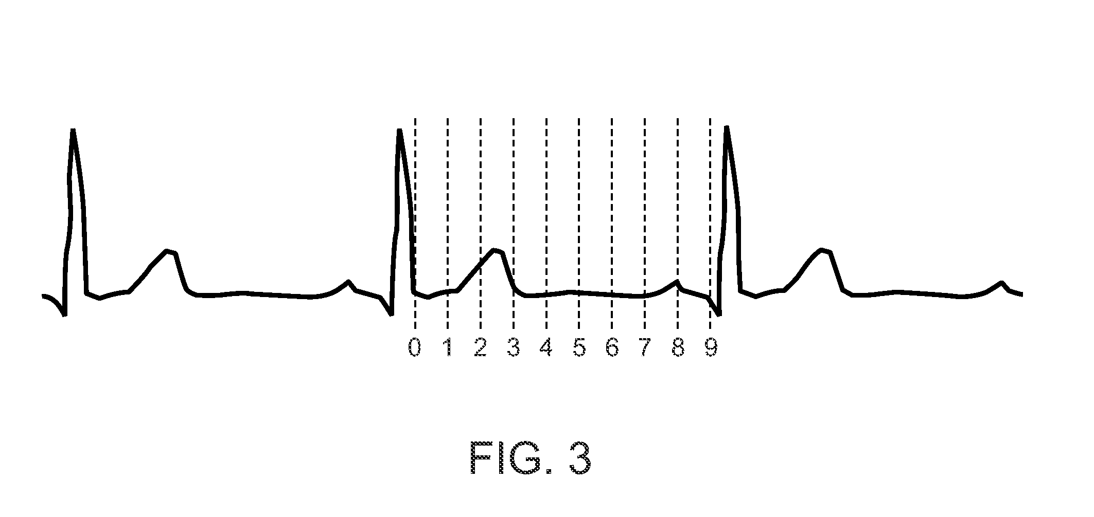 Radiation Treatment Planning and Delivery for Moving Targets in the Heart