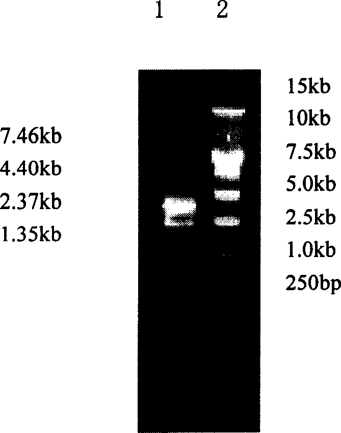 EHEC 0157 shiga-like toxin IIA resisting subunit monoclonal antibody 5F3 light and heavy chain variable region gene and its application