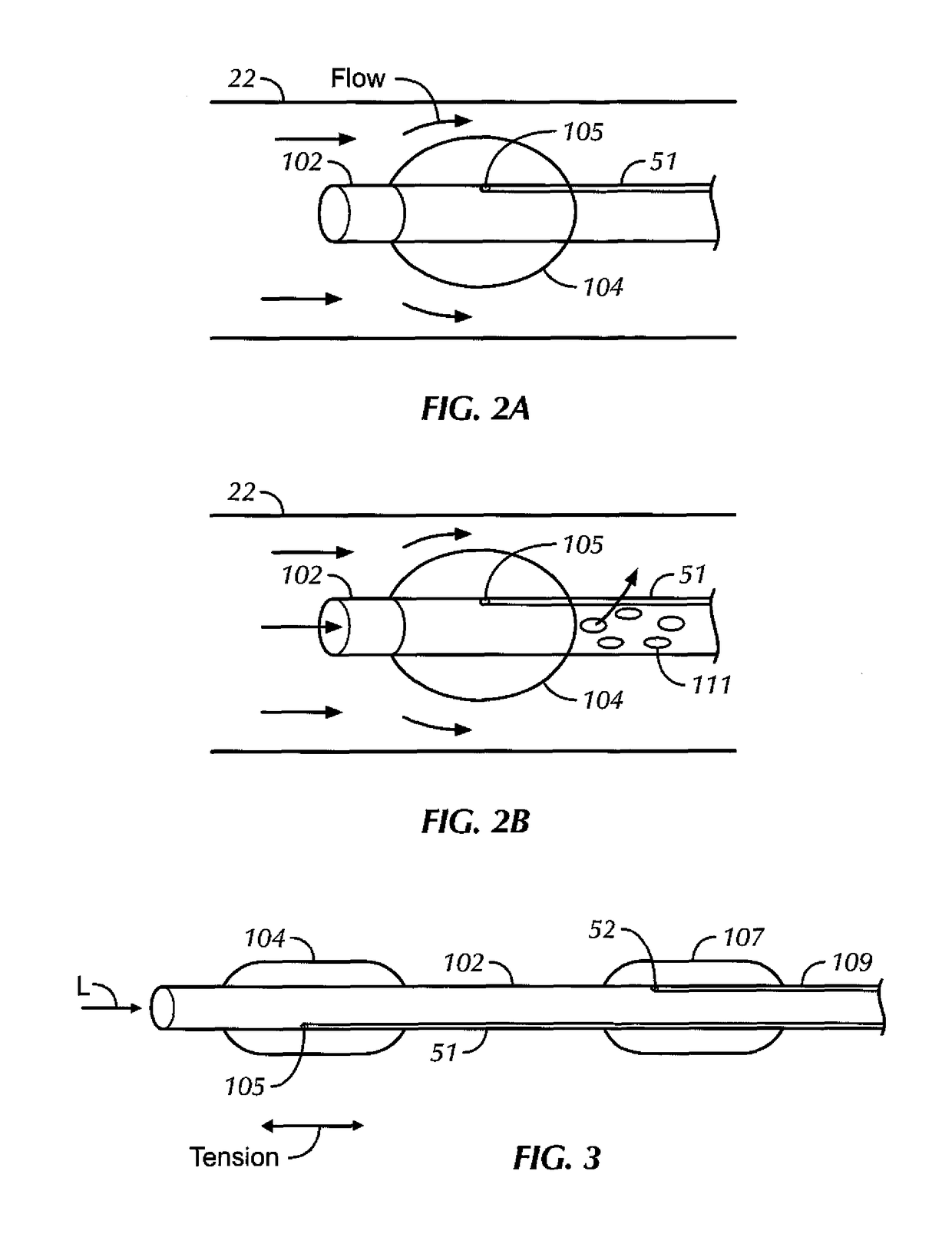 Aortic occluder with tensioned balloons