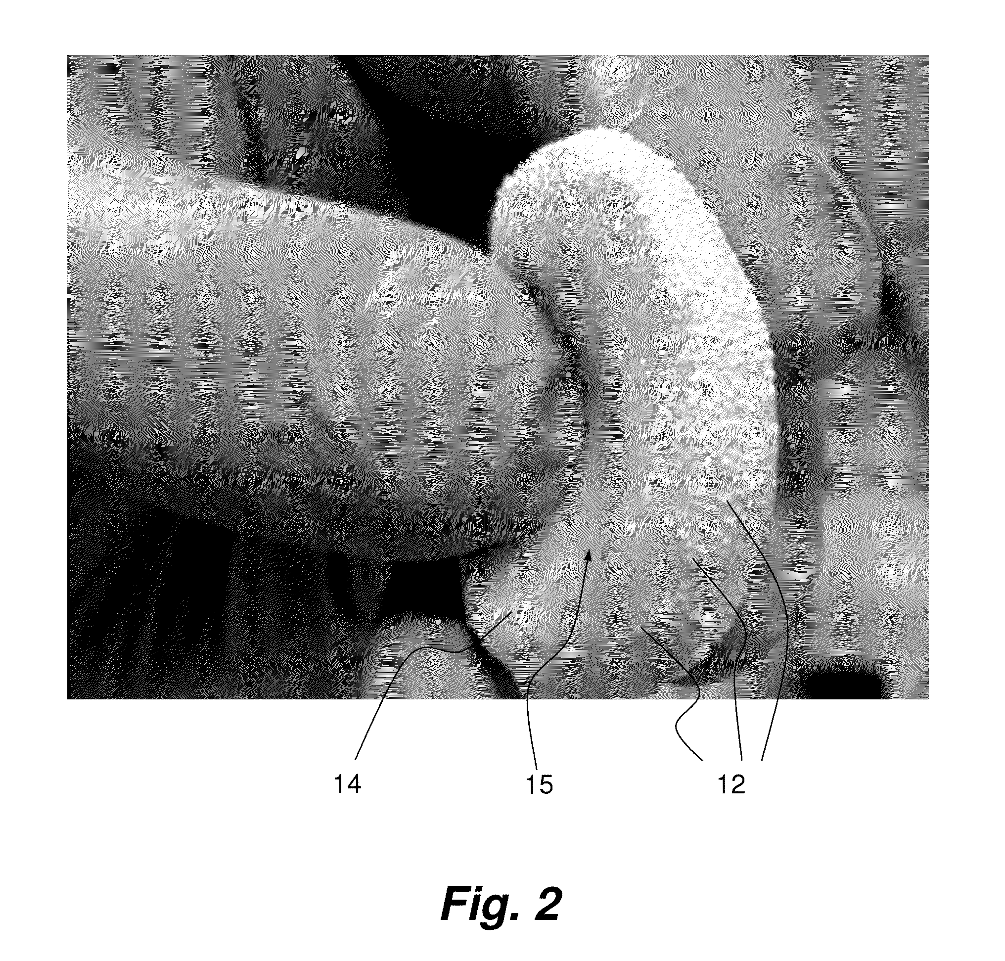 Method for preparing biocompatible and biodegradable biomaterials based on collagen and granules of hydroxyapatite/β-tricalcium phosphate for use in surgery, and biomaterials thus obtained