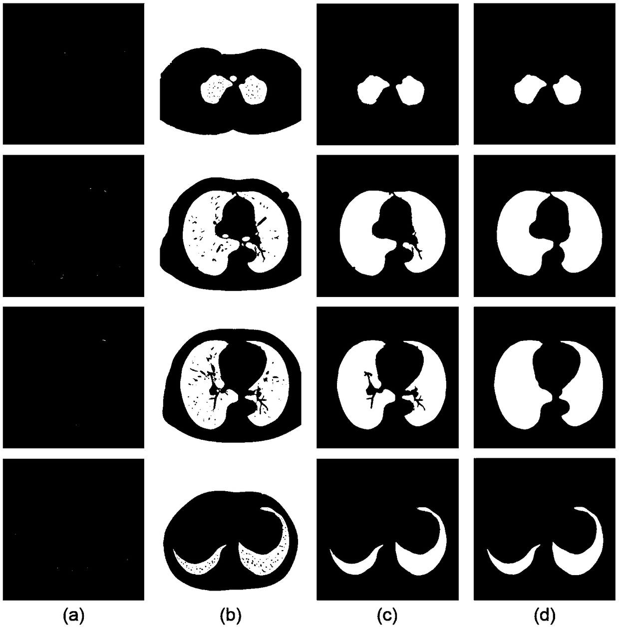 A system for detecting and diagnosing lung neoplasms on CT images