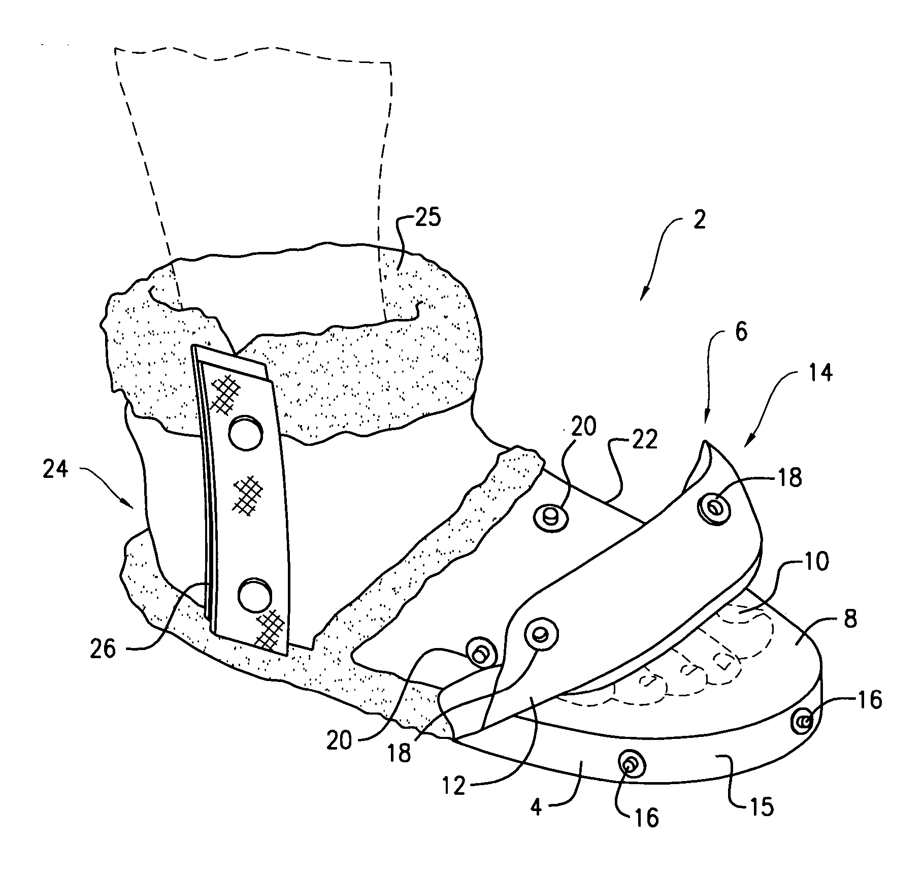 Pedicure boot