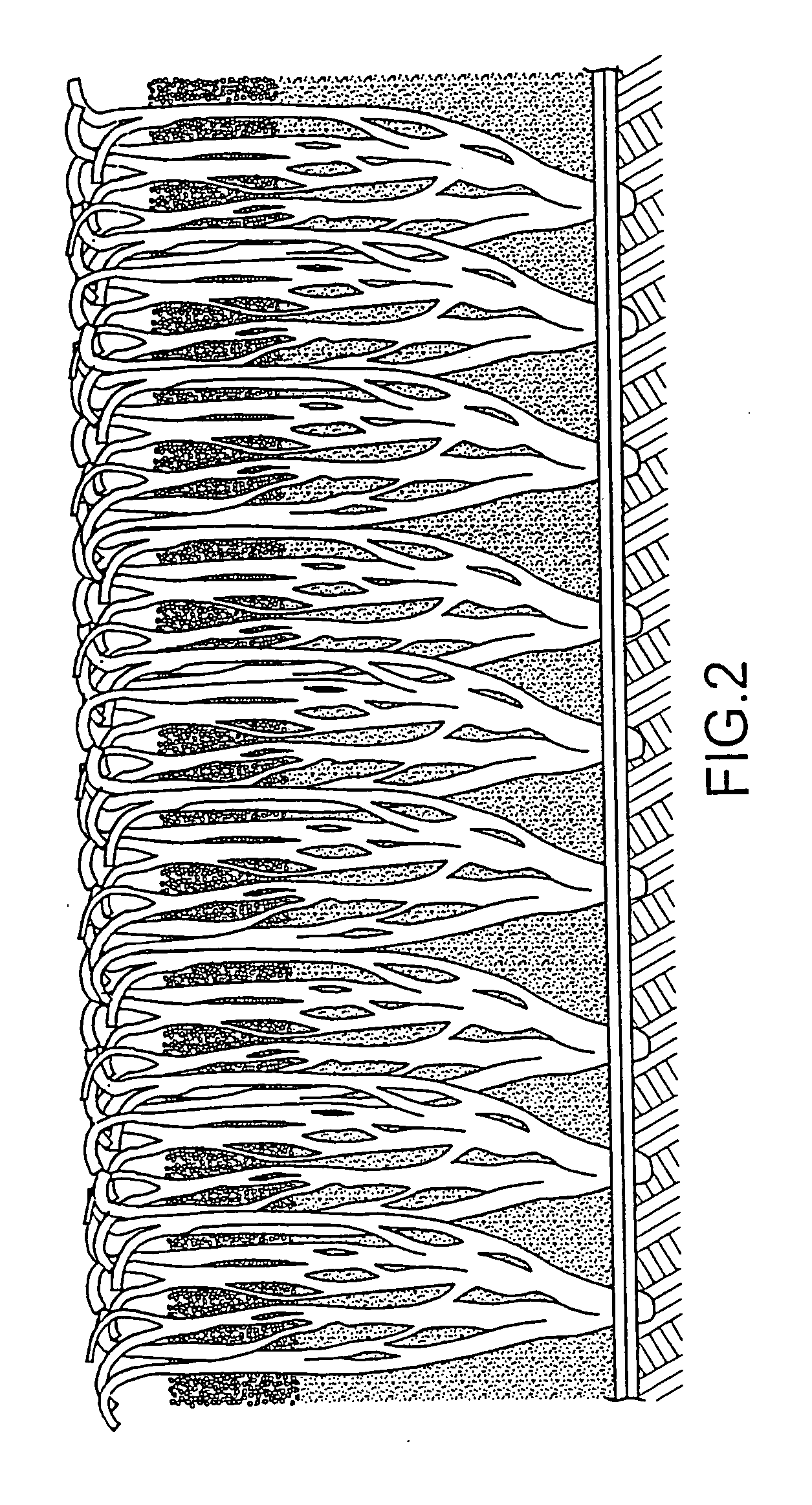 Synthetic grass with resilient granular top surface layer