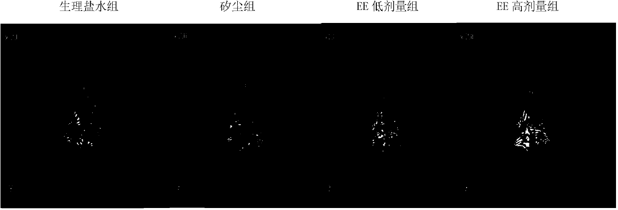 Application of earthworm extract to medicines