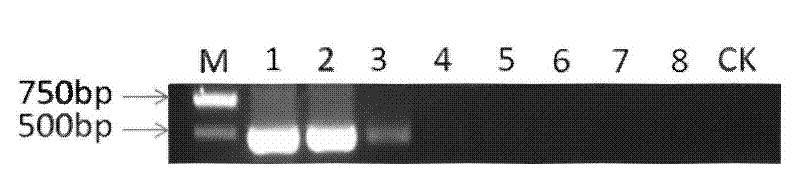 Detection primers and molecule detection method for pathogenic fungi of austral puccinia sorghi