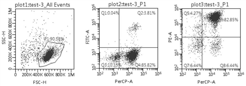 A kind of preparation method and special culture medium of tumor tissue til cells