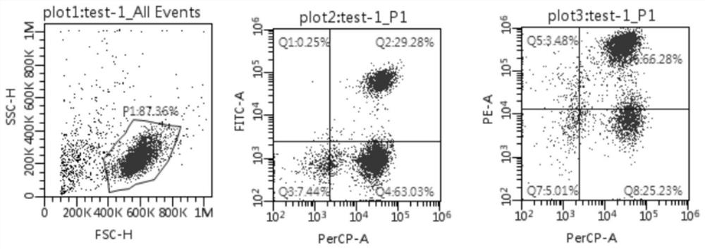 A kind of preparation method and special culture medium of tumor tissue til cells