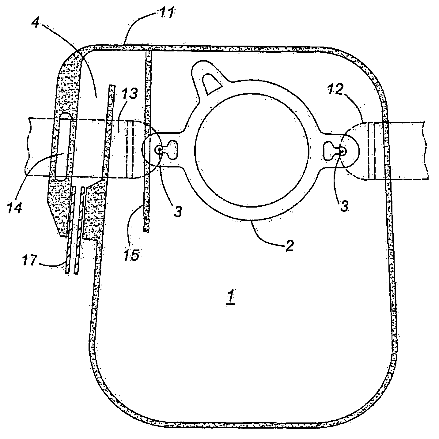 Colostomy bag