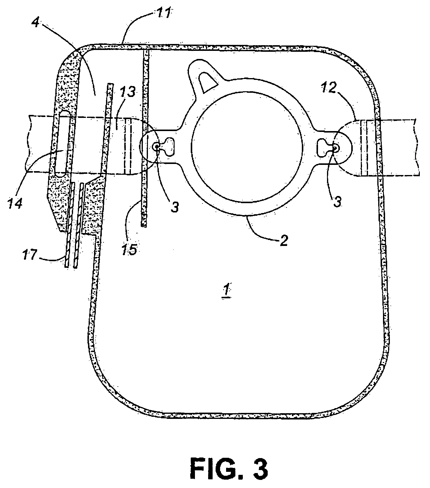 Colostomy bag