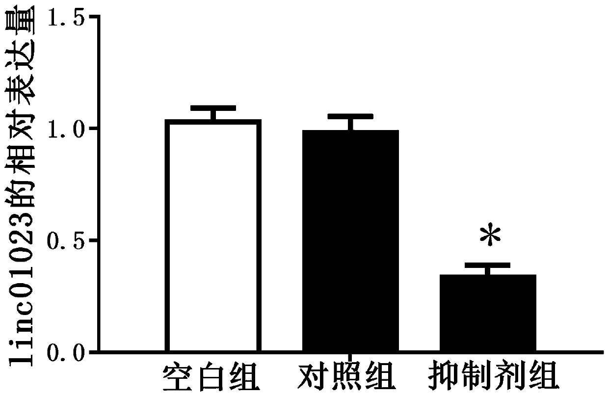 Inhibitor for inhibiting targeting linc01023 gene of human brain glioma and application of inhibitor