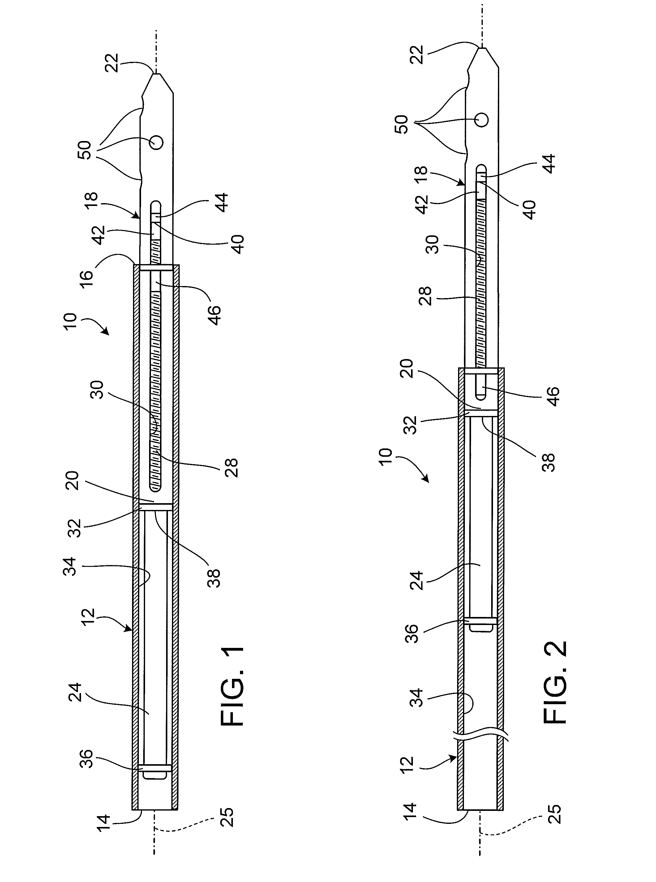 Telescoping IM nail and actuating mechanism