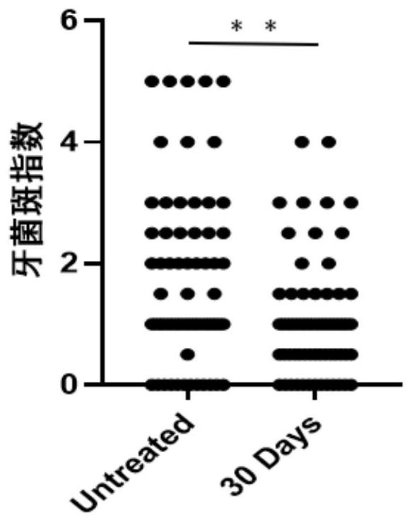 Biological polysaccharide for preventing and treating oral diseases and application thereof