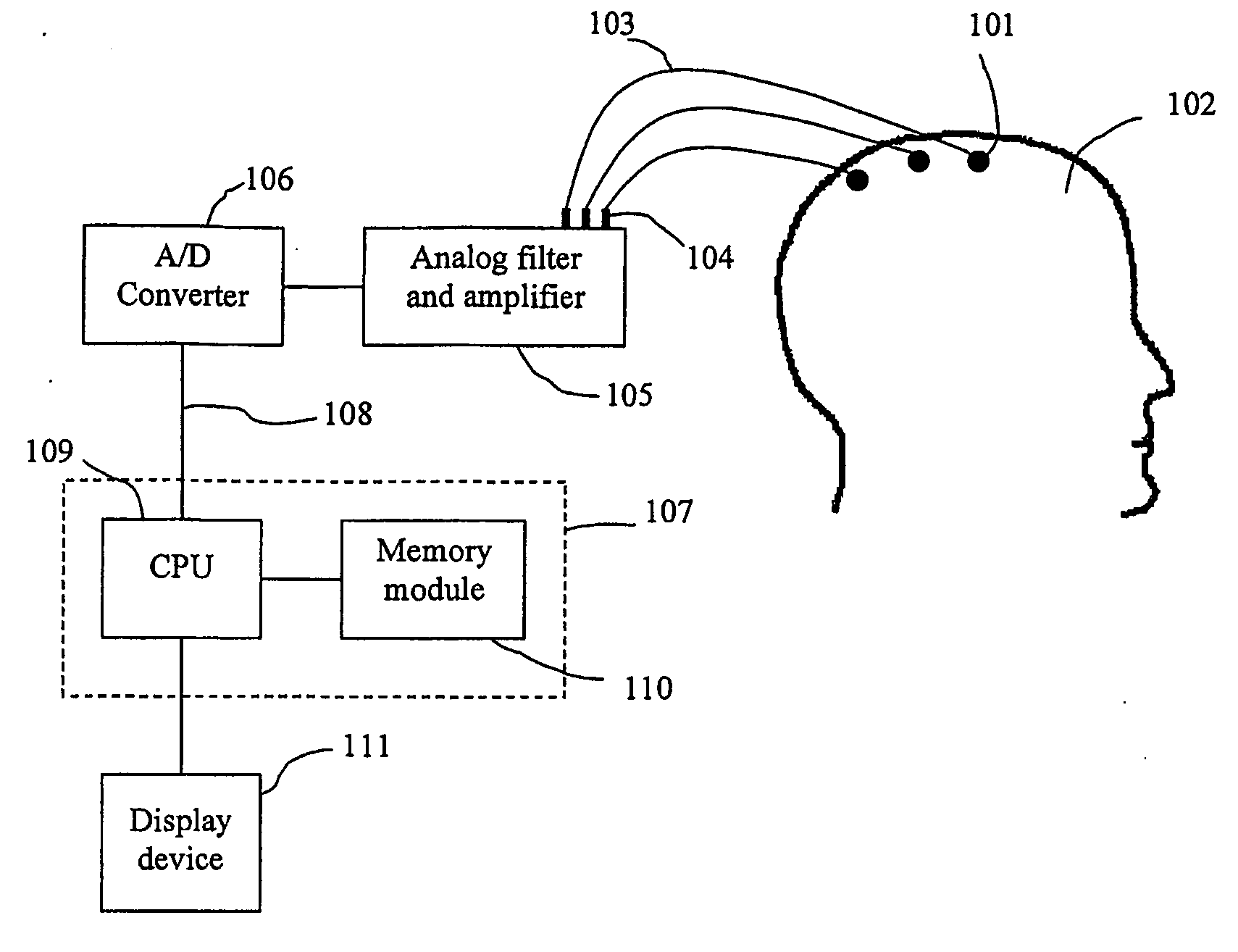 Method of monitoring brain function