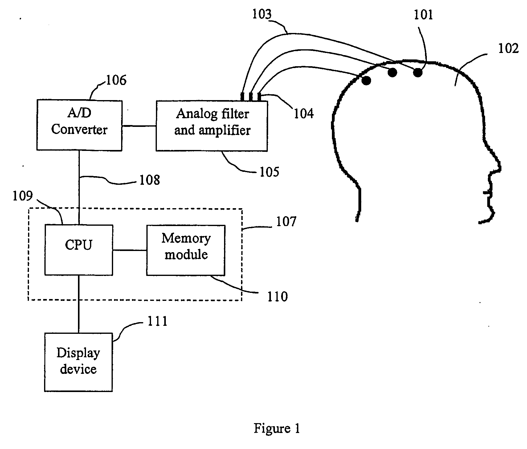 Method of monitoring brain function