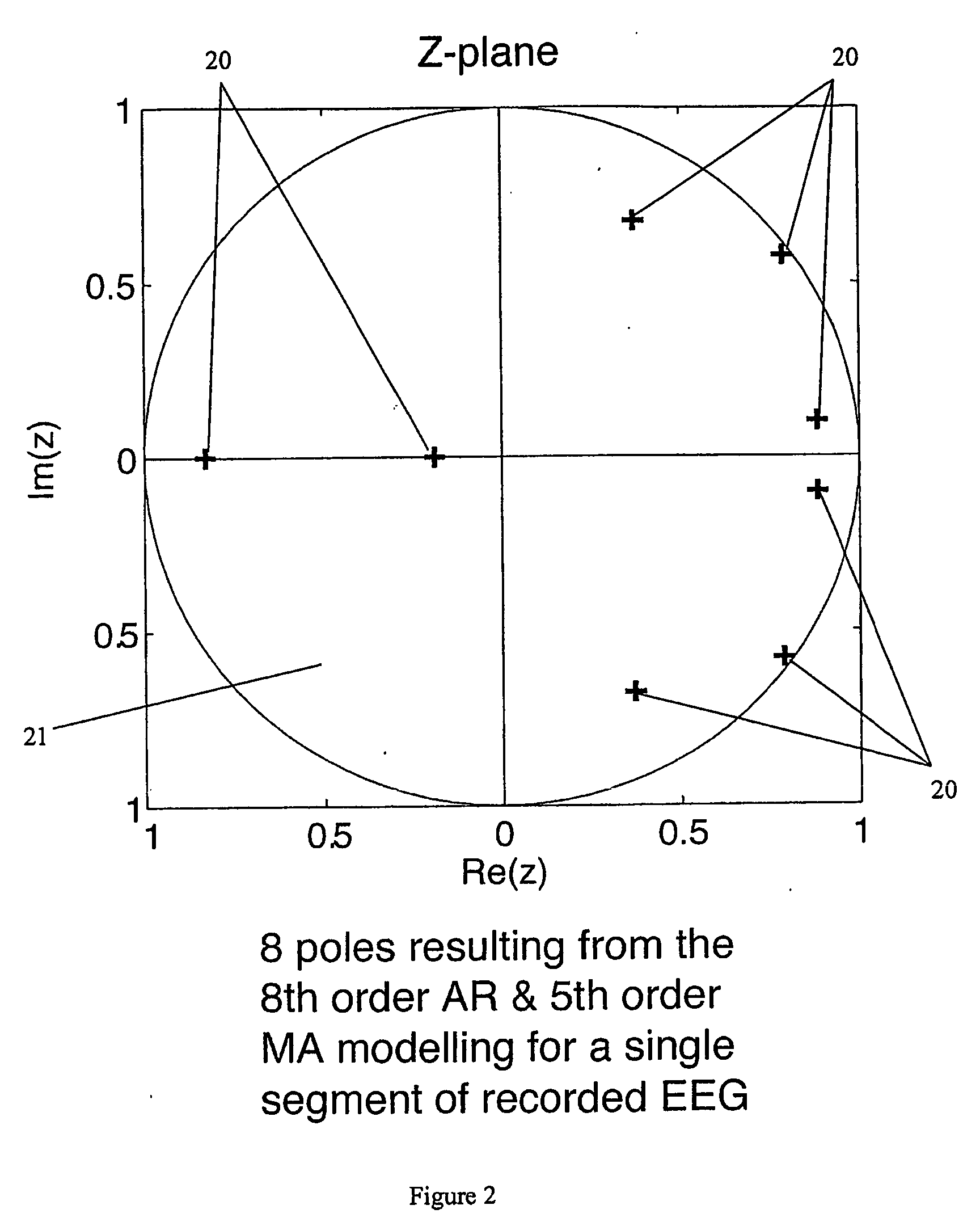 Method of monitoring brain function