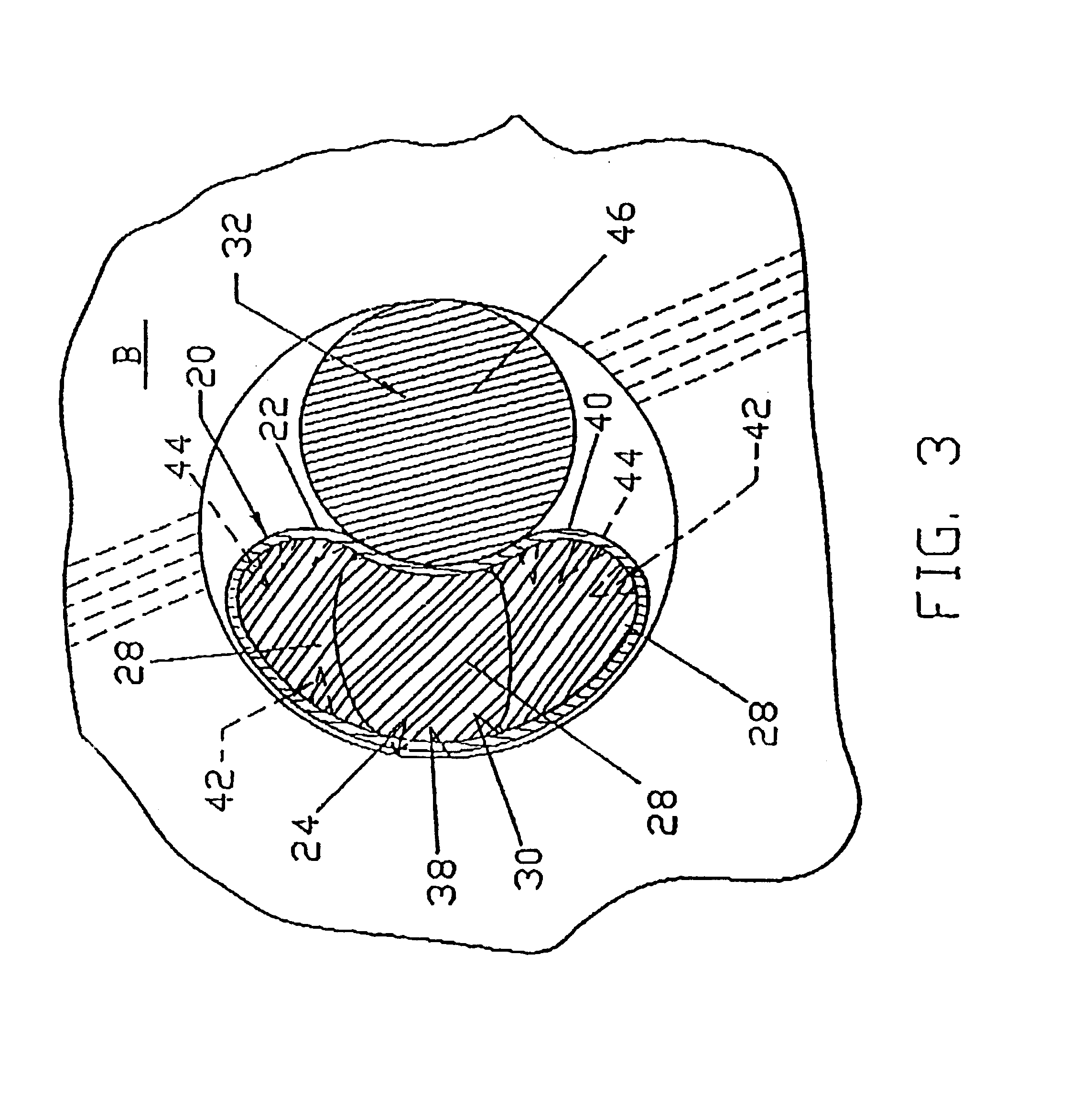 Graft ligament anchor and method for attaching a graft ligament to a bone