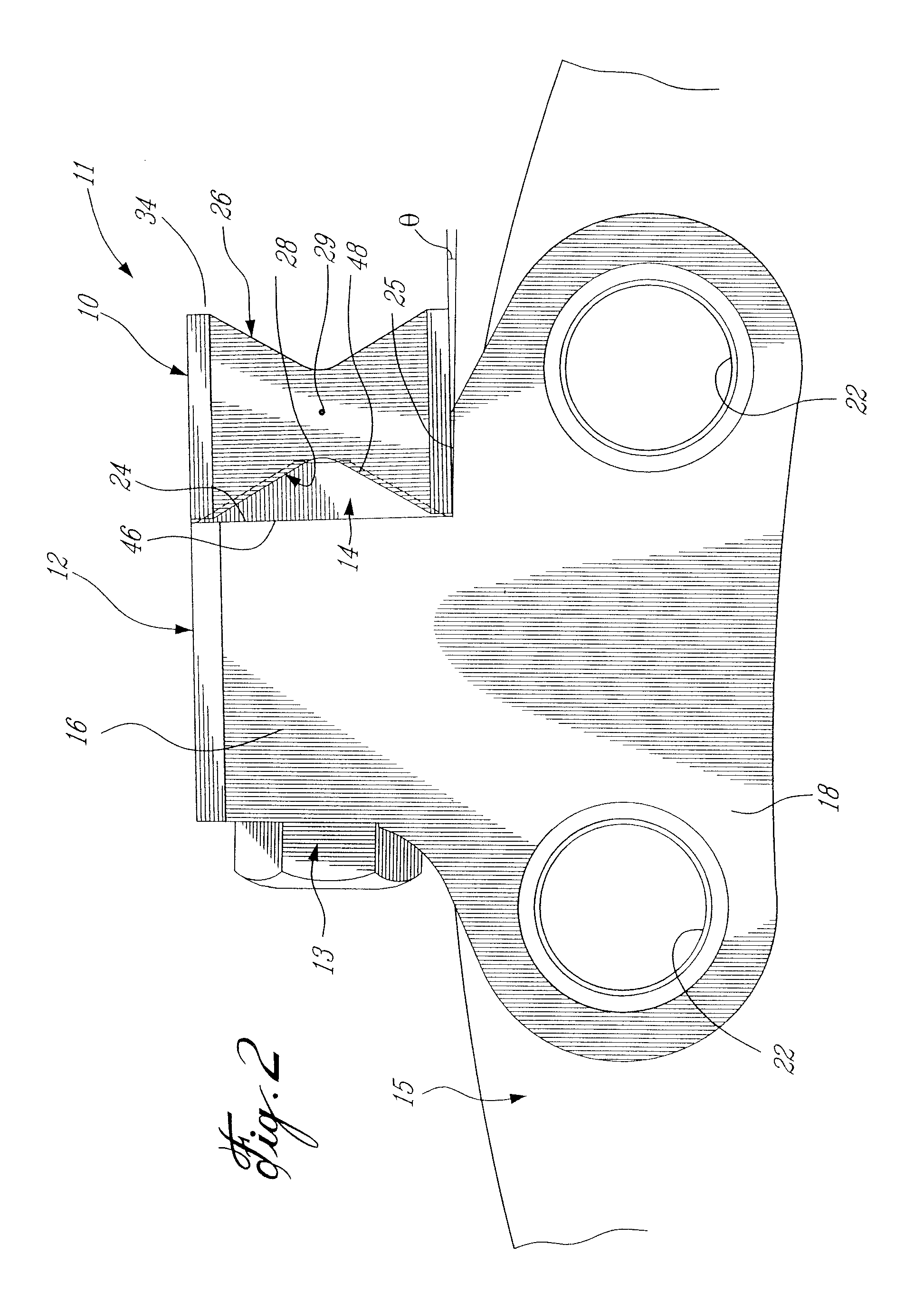 Rotary cutting machine with replaceable cutting teeth