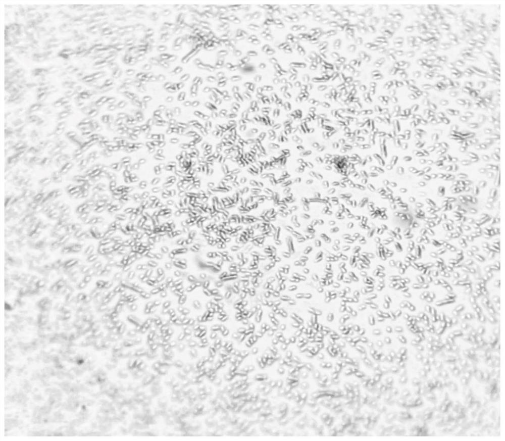 Akkermansia muciniphila and application thereof to preparation of antitumor drug