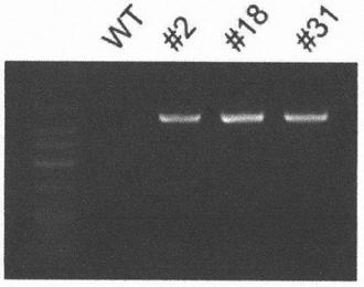 Basic group editing system and method for specifically repairing HBB gene mutation, kit and application of system and method and kit in human genital system