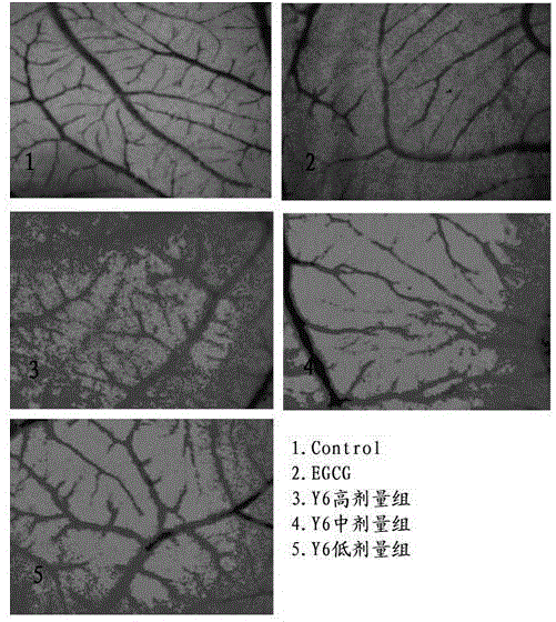 Application of EGCG structure modified derivatives in preparation of blood vessel regulating and controlling medicine