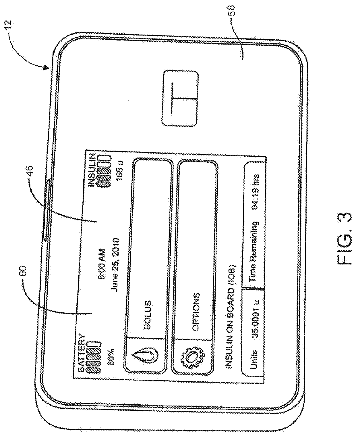 System and method for switching between closed loop and open loop control of an ambulatory infusion pump