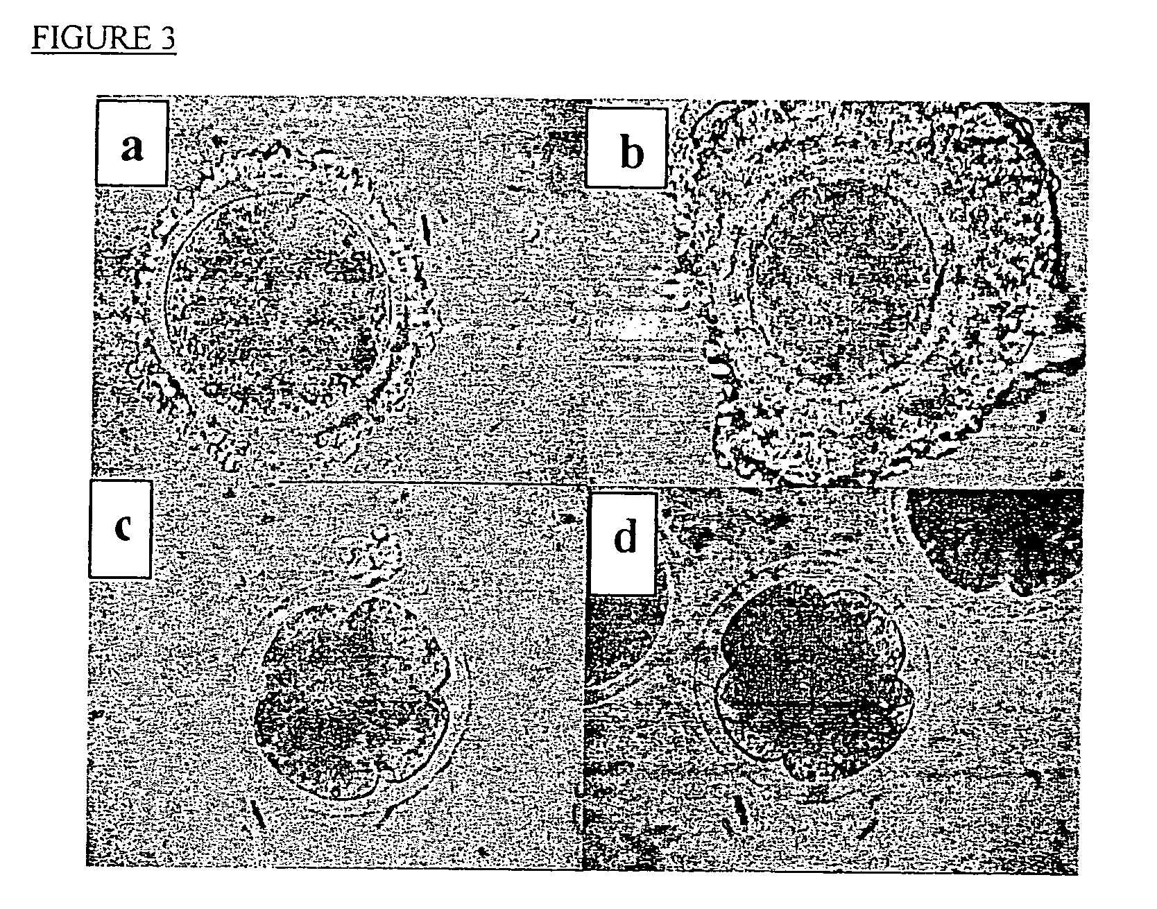 Methods of preserving functionality of an organ, preserving fertility of a patient undergoing a treatment expected to cause sterility and assuring a supply of viable gametes for future use