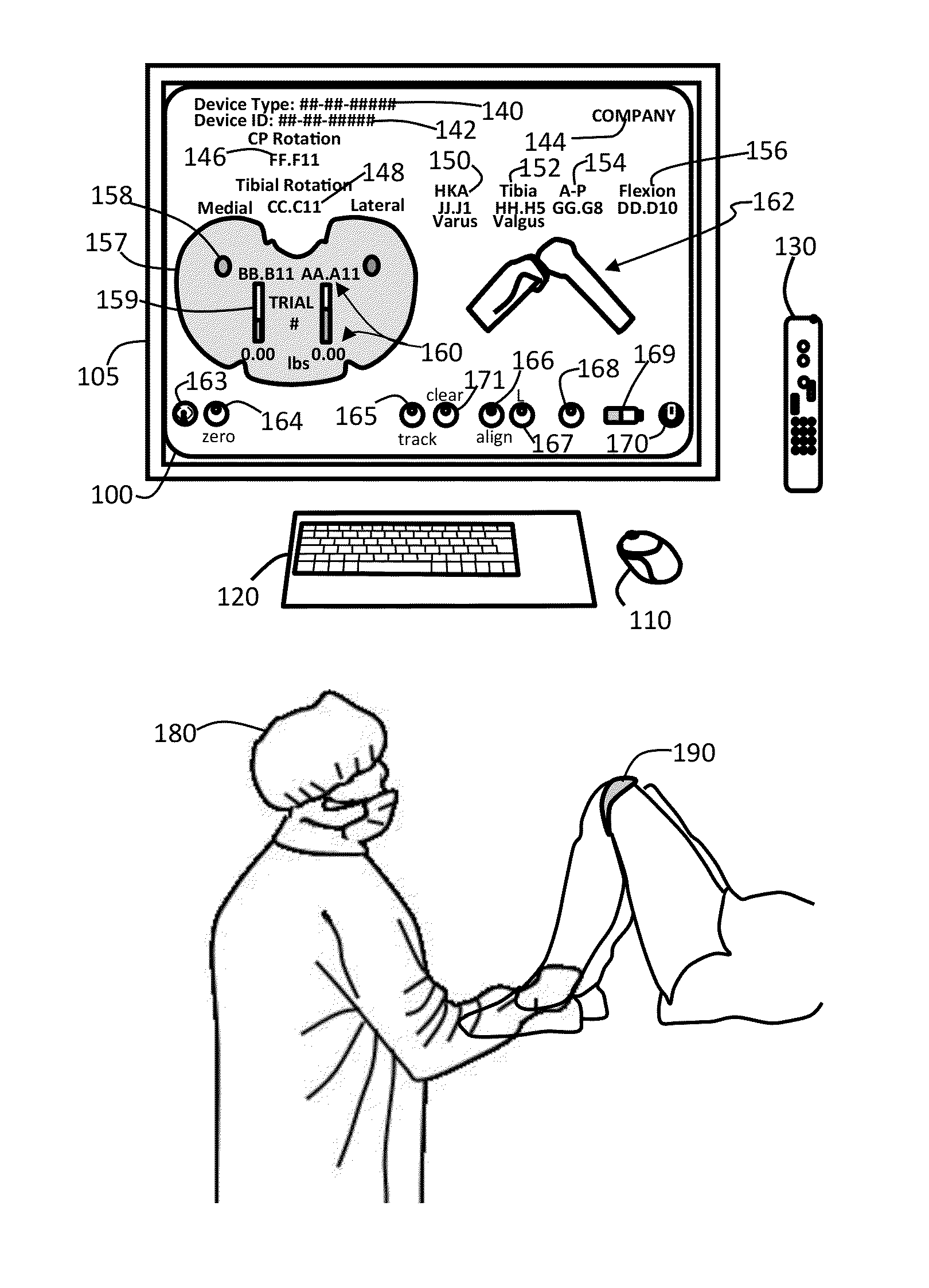 System and method for measuring muscular-skeletal alignment to a mechanical axis