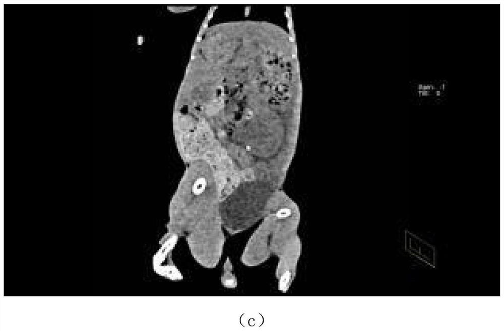 Construction method of animal ureteral calculus model