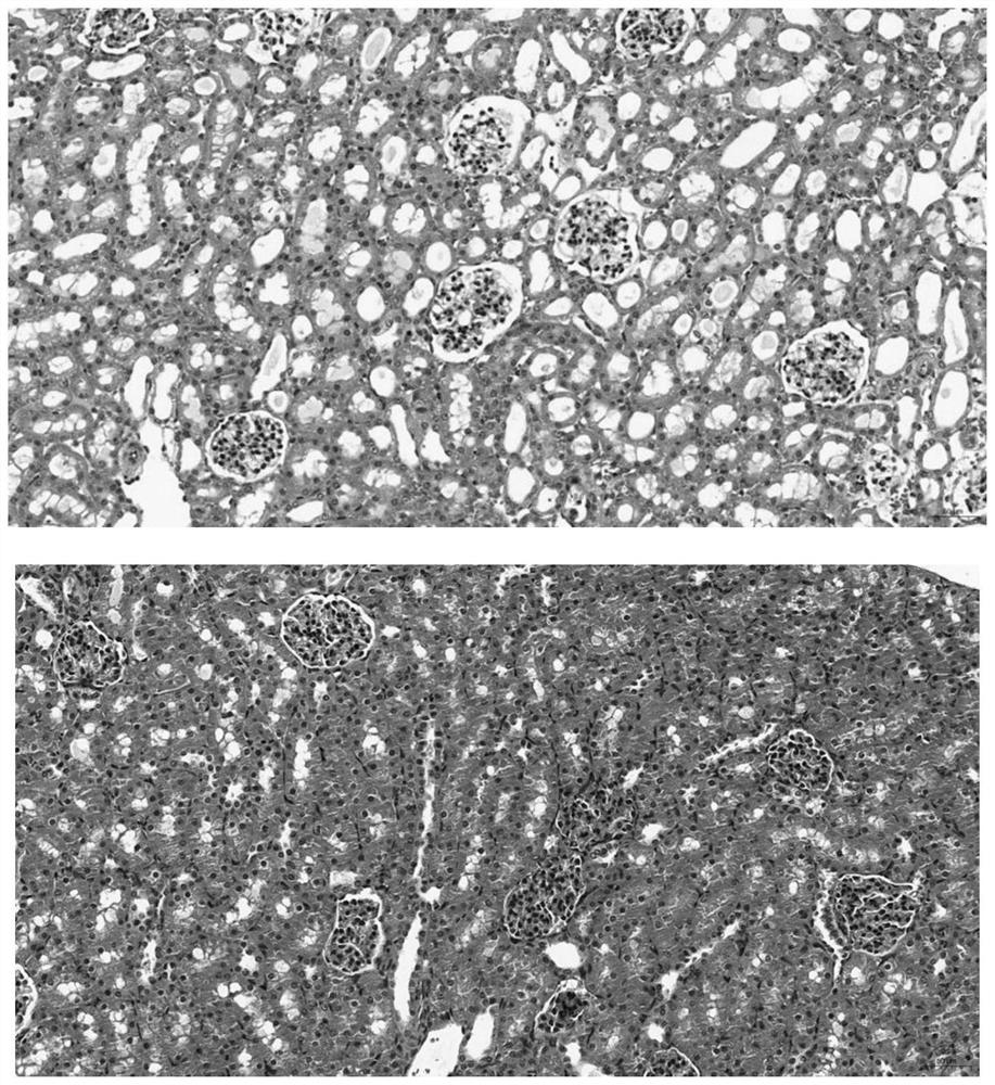 Construction method of animal ureteral calculus model