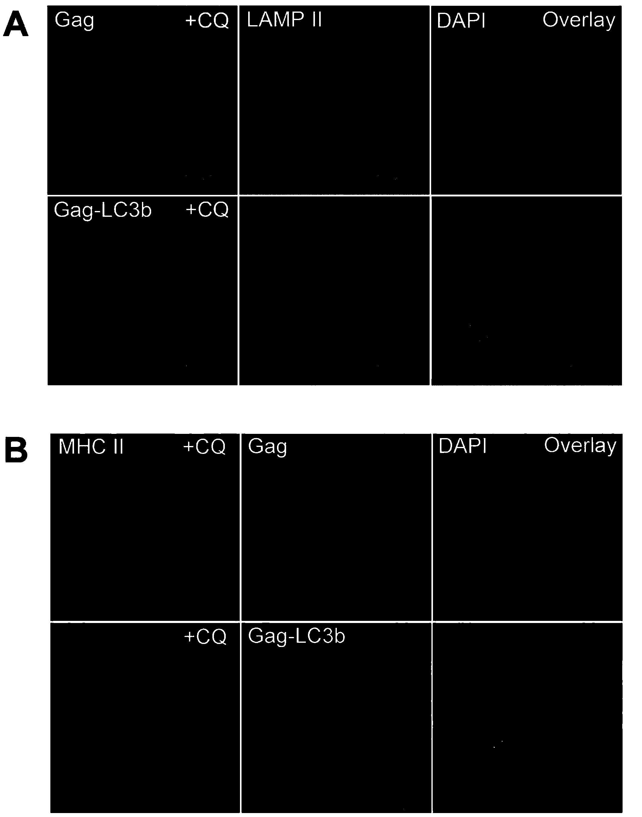 Novel HIV vaccine for triggering efficient CD4+T lymphocyte immune response