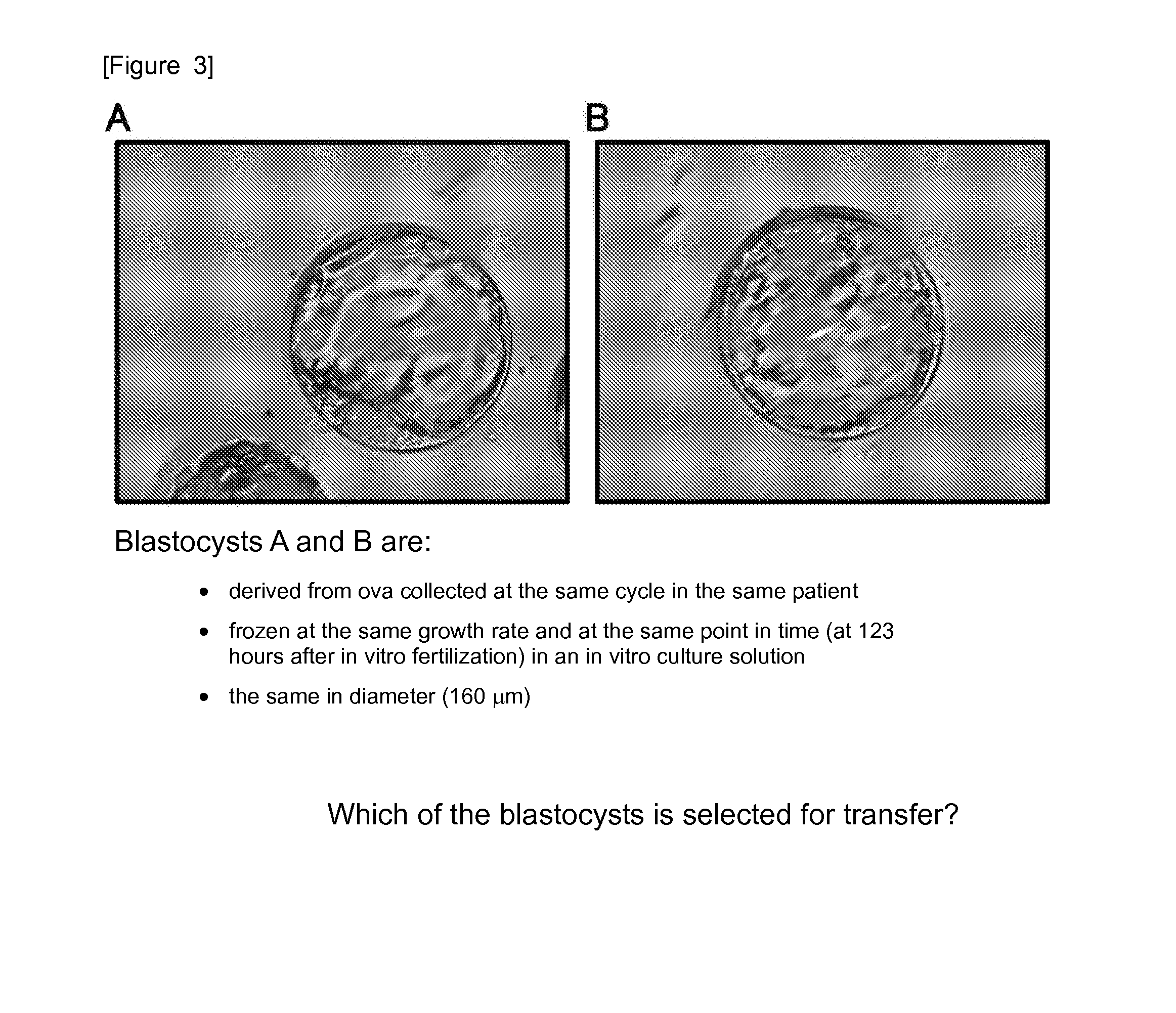 Method for evaluating human blastocyst by norepinephrine level in blastocyst culture solution