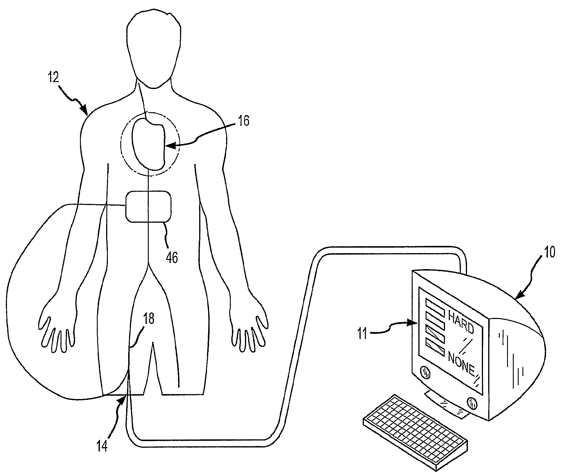 Assessment of Electrode Coupling For Tissue Ablation