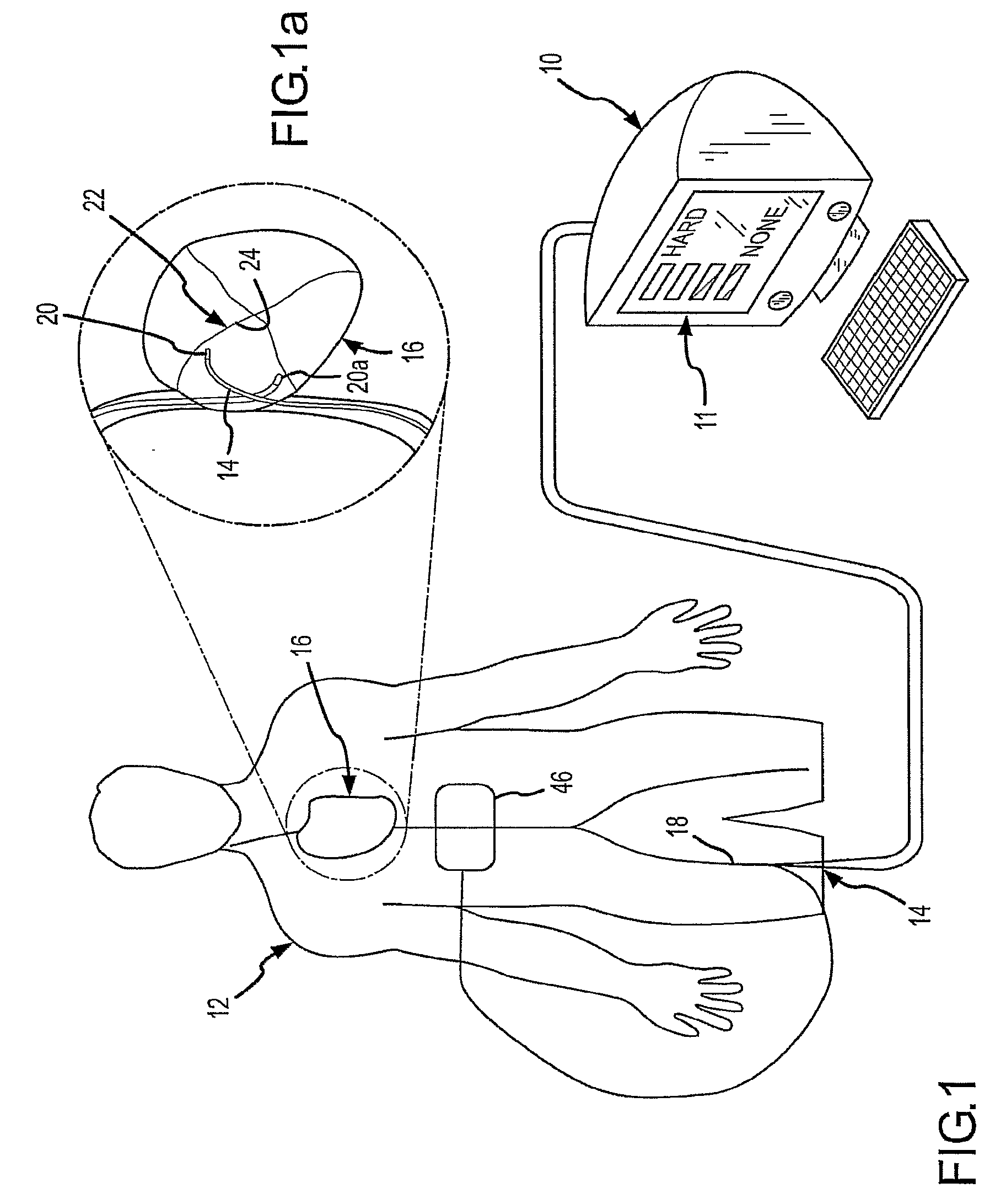 Assessment of Electrode Coupling For Tissue Ablation