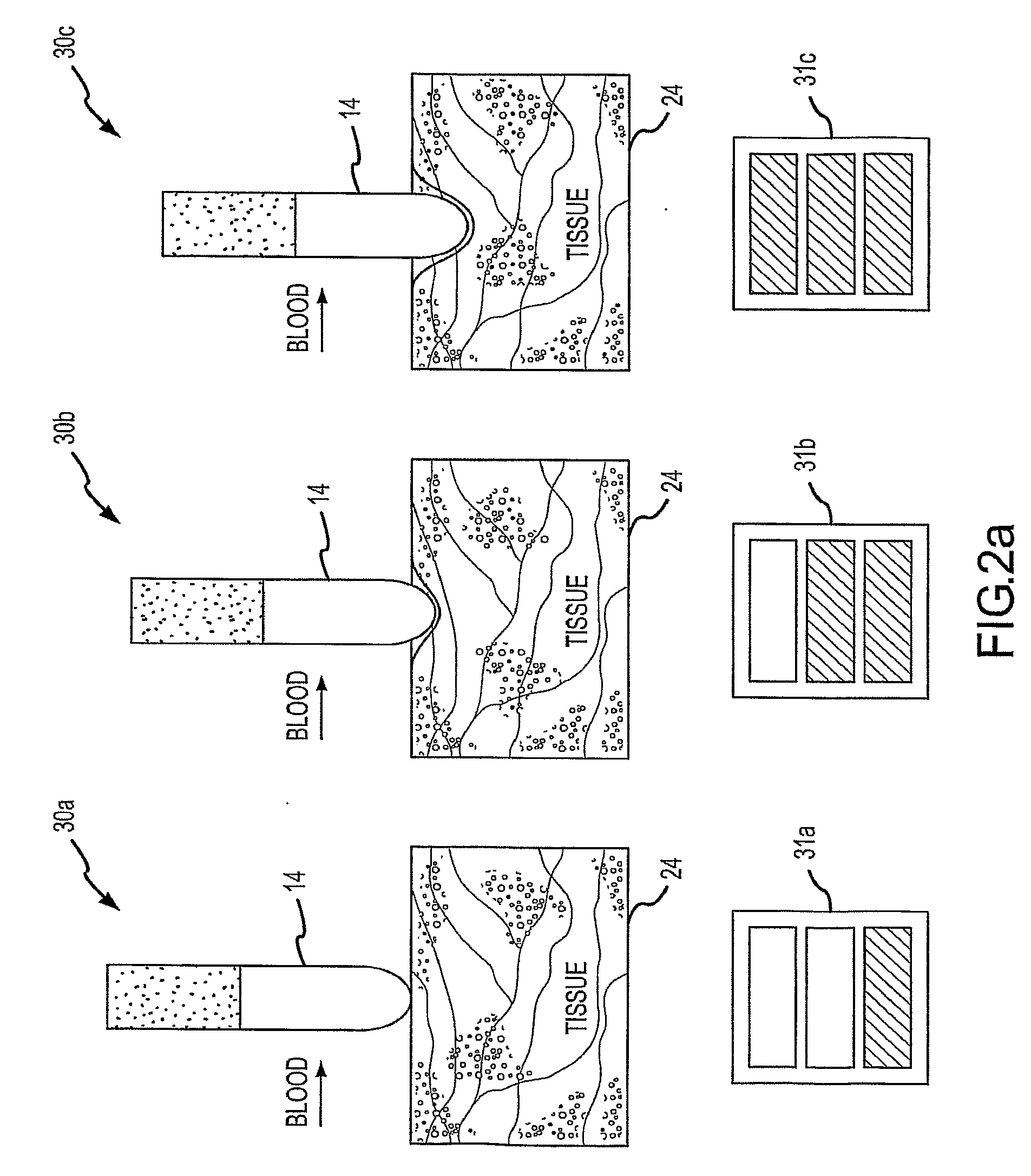 Assessment of Electrode Coupling For Tissue Ablation