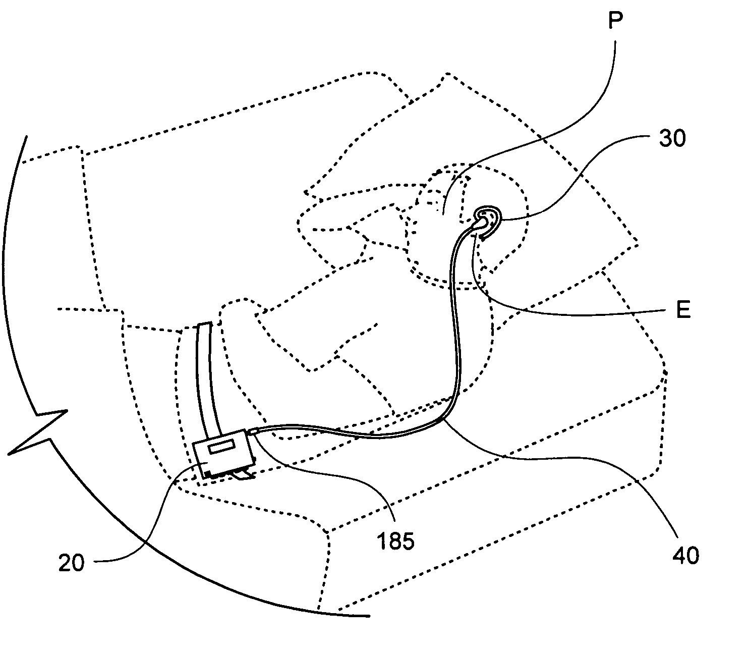 Discreet bed-wetting alarm and method of use thereof