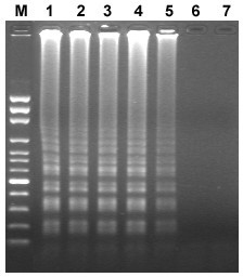 Lamp detection kit and detection method of macrobrachium rosenbergii dicistronic virus