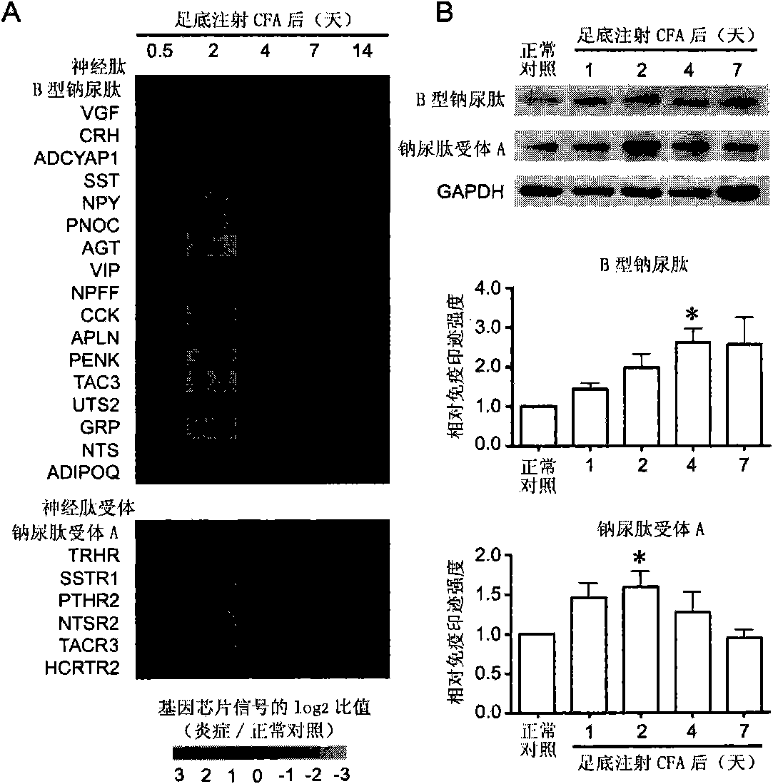 Purpose of agonist of natriuretic peptide receptor A in pain management