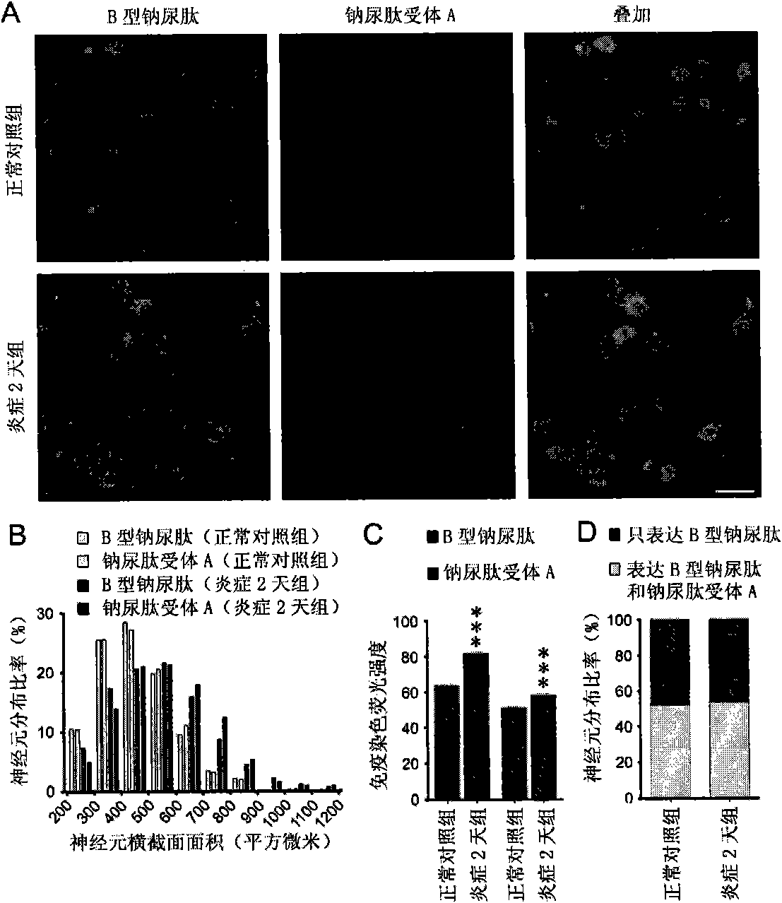 Purpose of agonist of natriuretic peptide receptor A in pain management