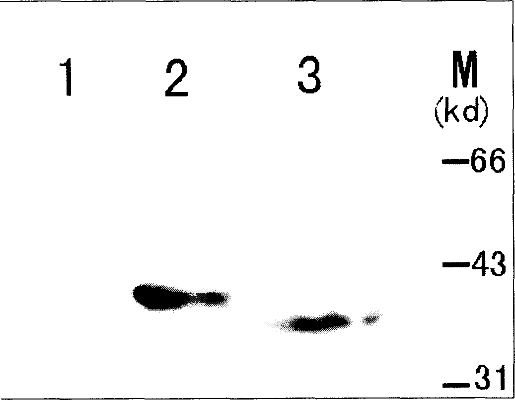 Optimization and extraction process of whole length polyclonal rabbit anti-human SMN antibody