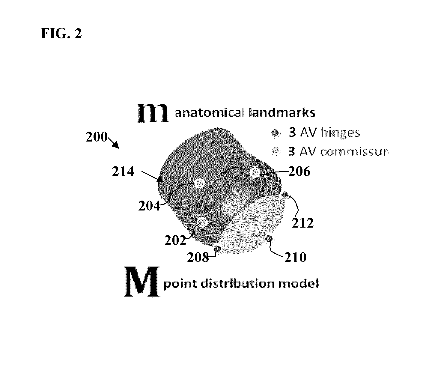 Method and system for intervention planning for transcatheter aortic valve implantation from 3D computed tomography data